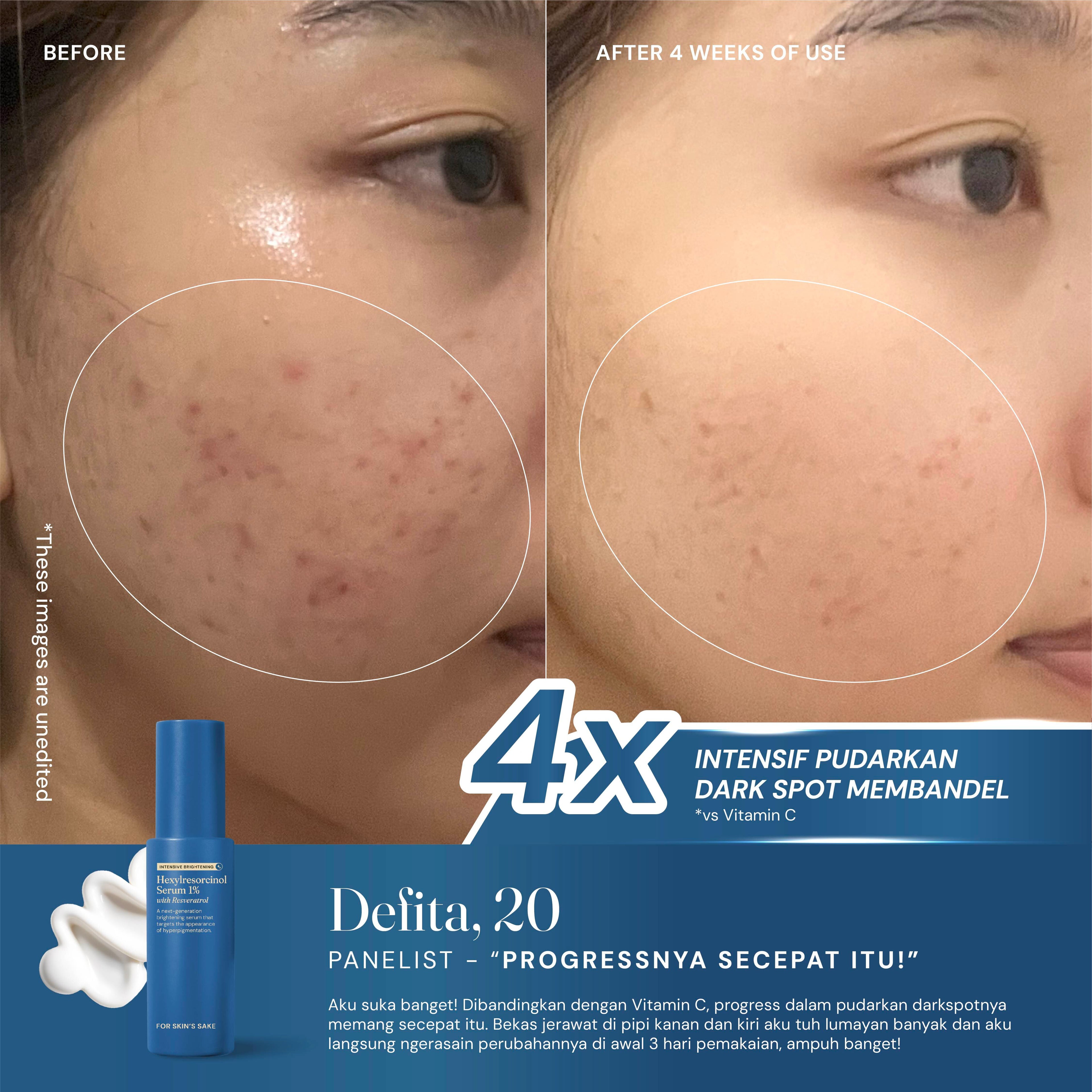 Hexylresorcinol Serum 1% with Resveratrol