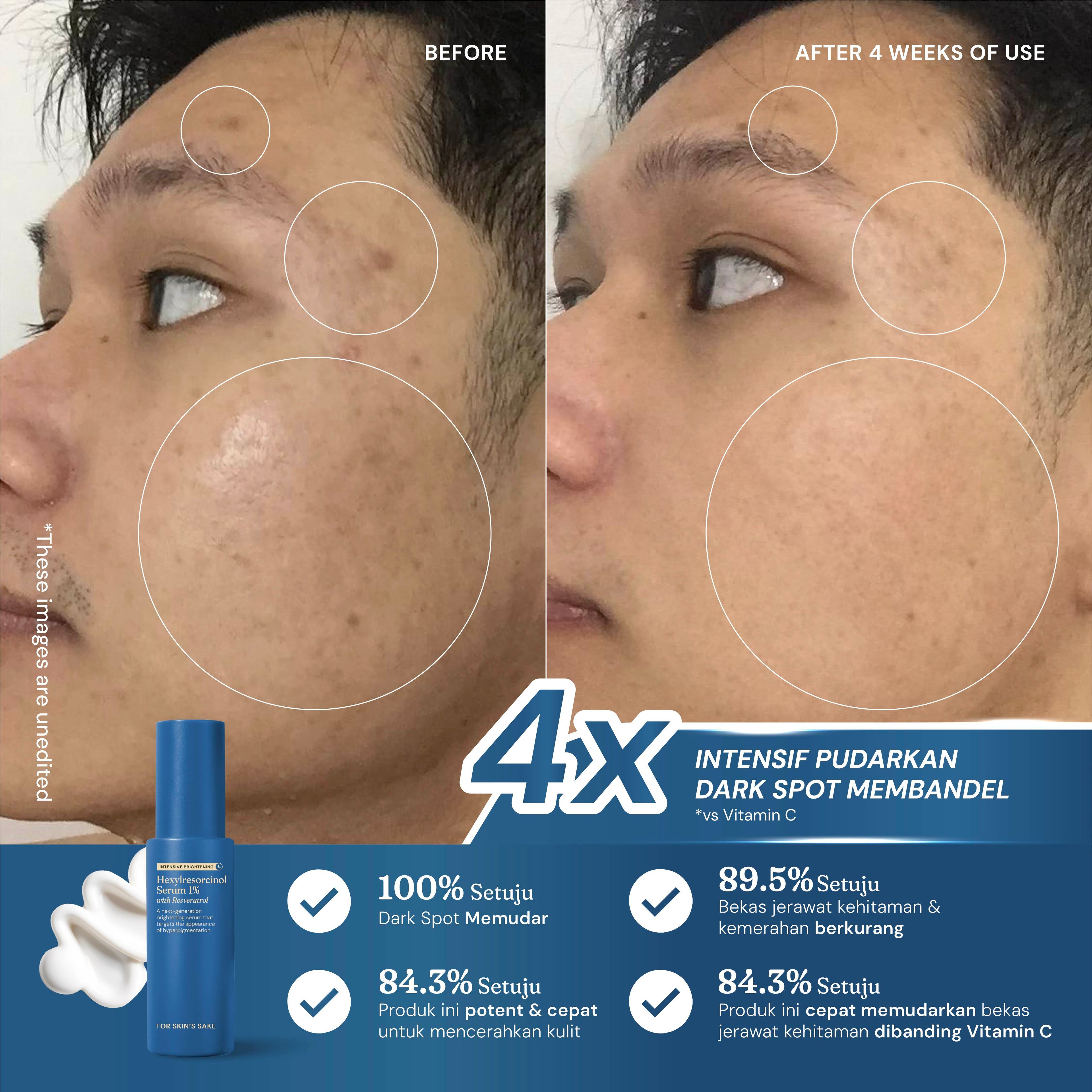 Hexylresorcinol Serum 1% with Resveratrol