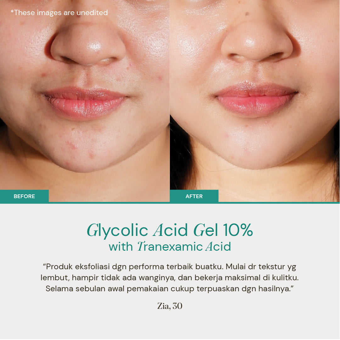 Glycolic Acid Gel 10% with Tranexamic Acid