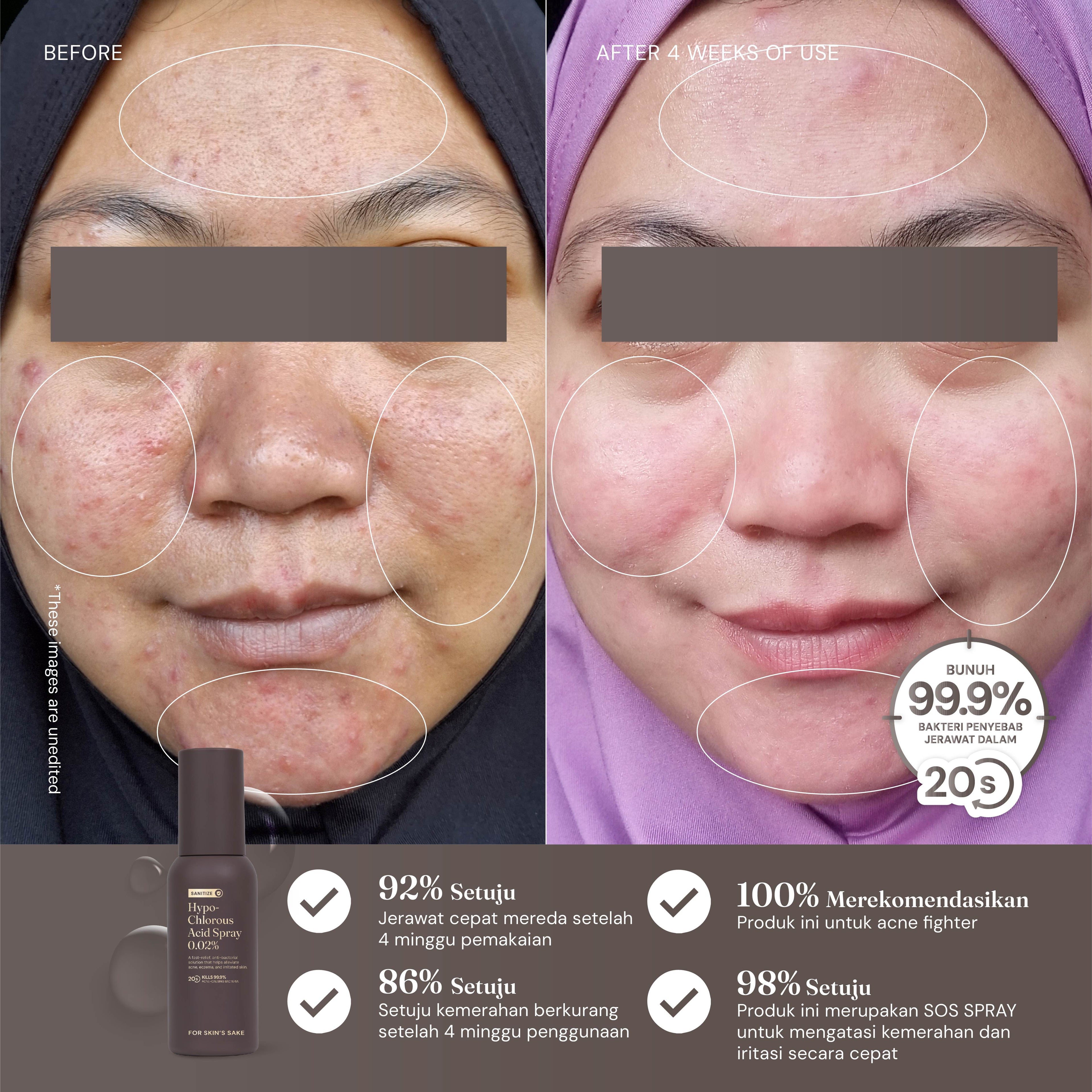 Hypochlorous Acid Spray HOCL 0.02%