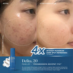 Hexylresorcinol Serum 1% with Resveratrol