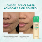 Mandelic Acid Gel 5% with Niacinamide