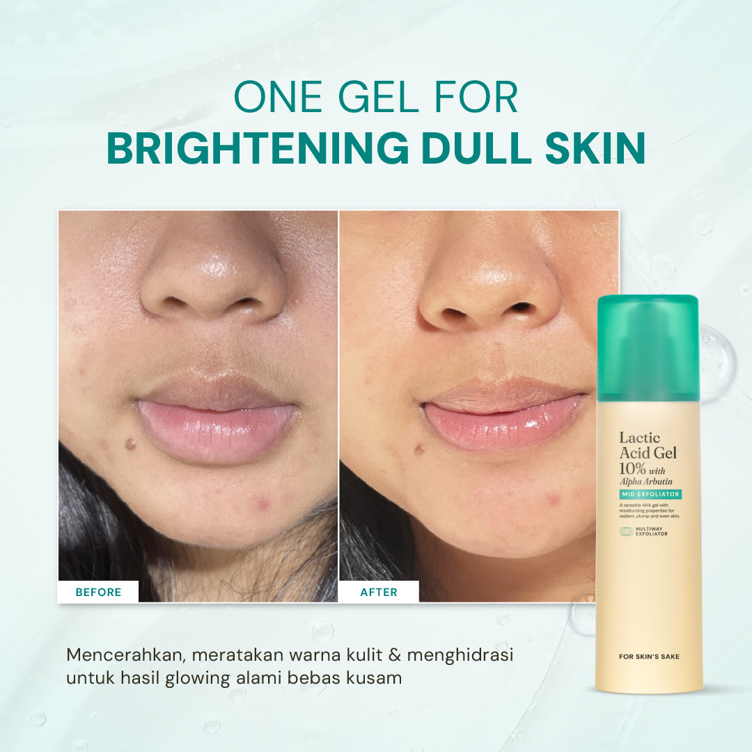 Lactic Acid Gel 10% with Alpha Arbutin