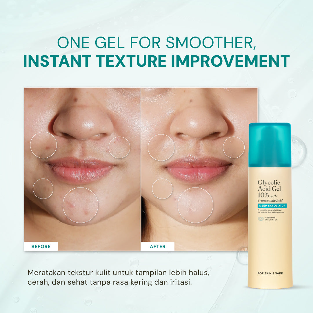 Glycolic Acid Gel 10% with Tranexamic Acid