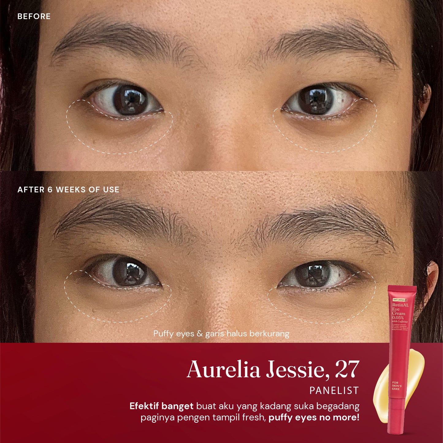 RetinAL Eye Cream 0.05% with Caffeine