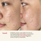 Retinol Cream 0.1% with Polyglutamic Acid