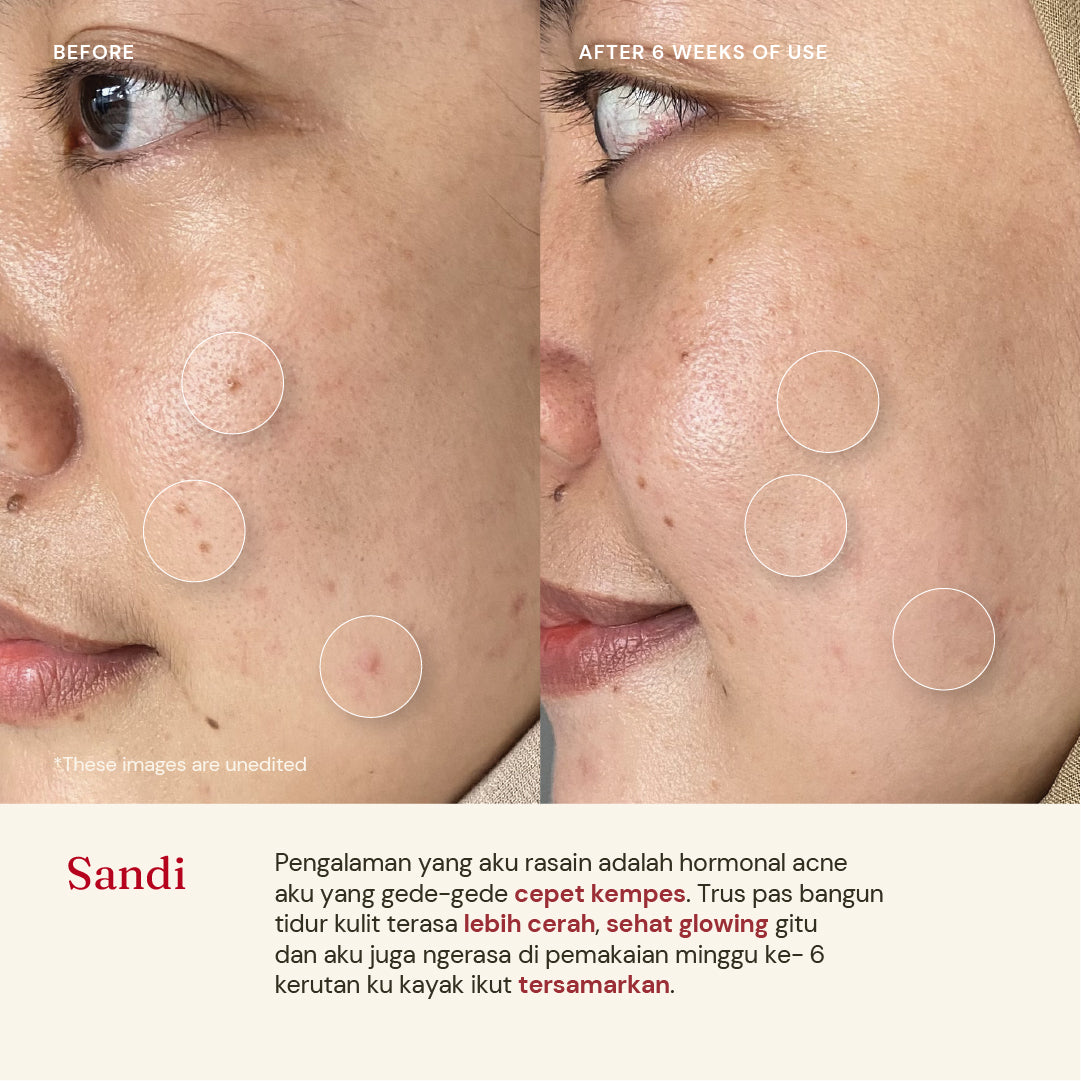 Retinol Cream 0.1% with Polyglutamic Acid