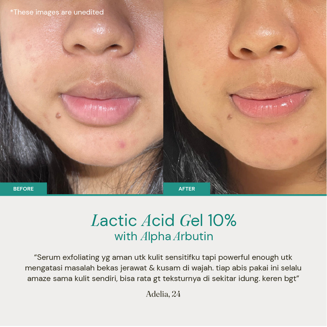 Lactic Acid Gel 10% with Alpha Arbutin