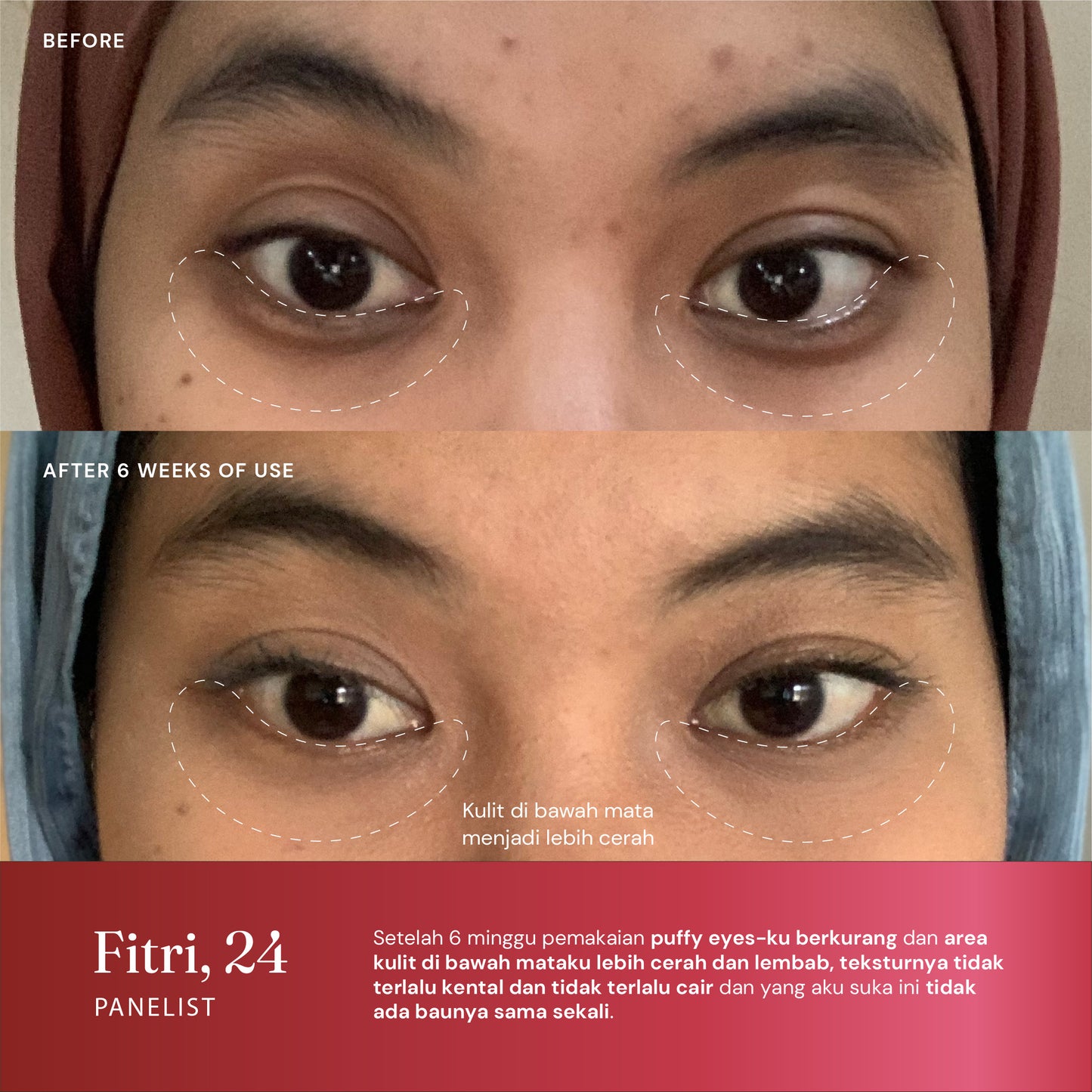 RetinAL Eye Cream 0.05% with Caffeine