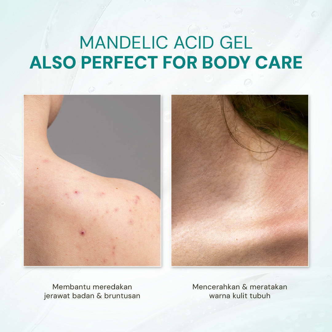 Mandelic Acid Gel 5% with Niacinamide