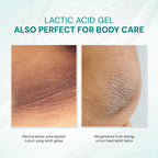 Lactic Acid Gel 10% with Alpha Arbutin