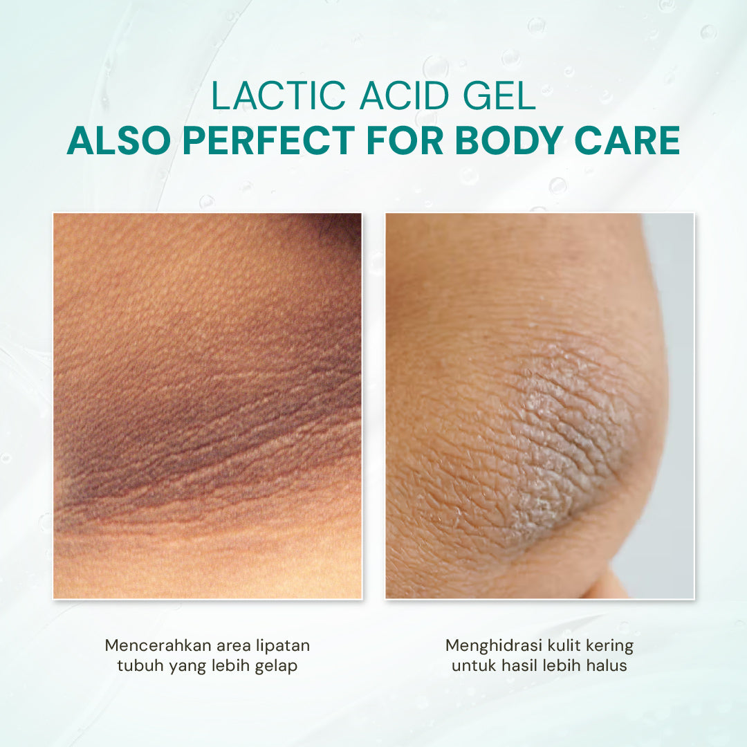 Lactic Acid Gel 10% with Alpha Arbutin