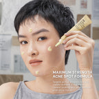 For Skin’s Sake FSS Sulfur Acne Spot 10% Acne Spot Obat Totol Jerawat Treatment dengan Salicylic Acid 2% + Niacinamide 4% untuk Membantu Mengempiskan Jerawat Aktif, Meradang, Kemerahan dan Mengontrol Minyak