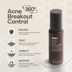 For Skin’s Sake FSS Dioic Acid Serum 2% with Azeclair 3.5% 30ml Acne Serum 360° Breakout Control Bantu Cegah dan Atasi Jerawat Berulang Kontrol Minyak serta Samarkan Bekas Jerawat PIE dan PIH