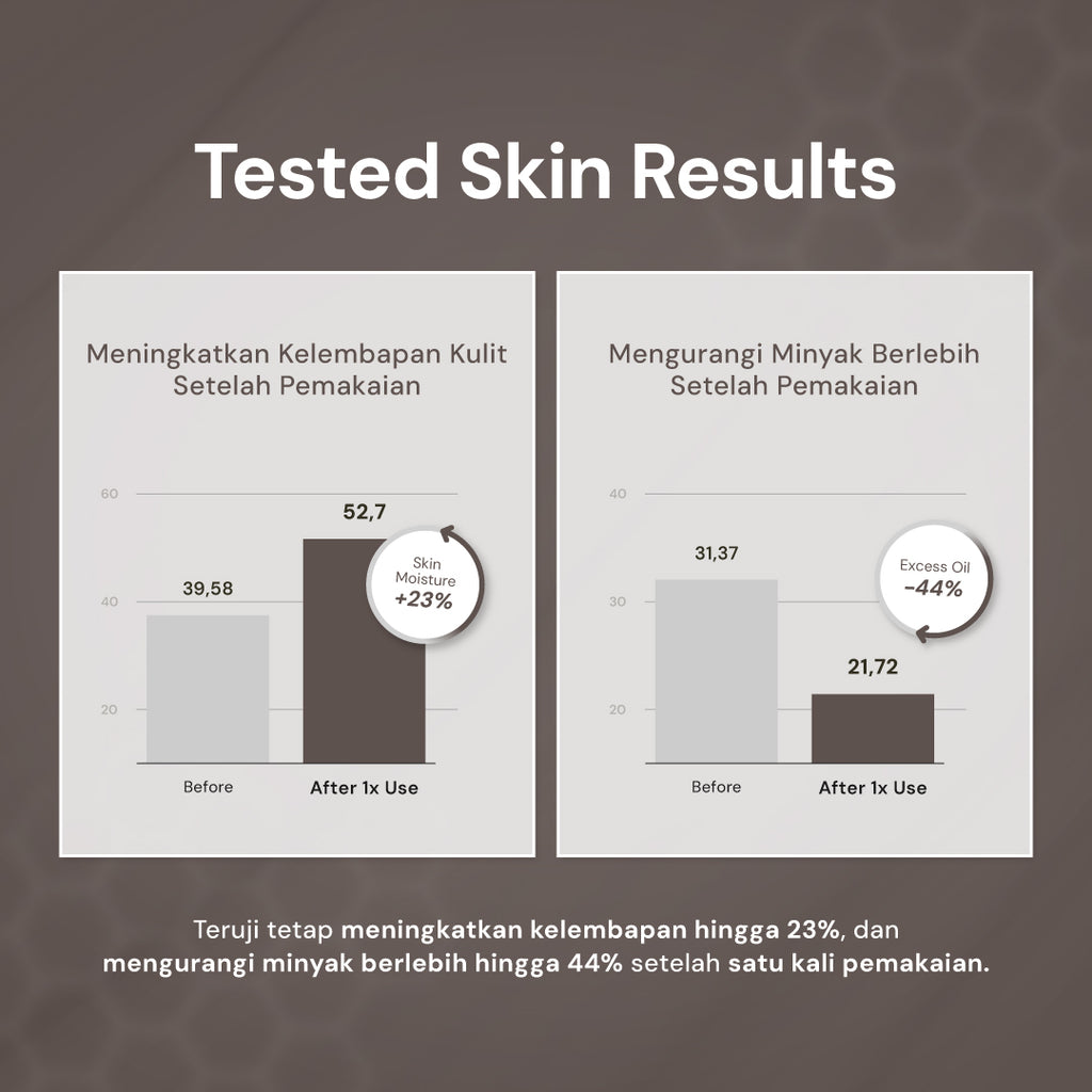 For Skin’s Sake FSS Dioic Acid Serum 2% with Azeclair 3.5% 30ml Acne Serum 360° Breakout Control Bantu Cegah dan Atasi Jerawat Berulang Kontrol Minyak serta Samarkan Bekas Jerawat PIE dan PIH