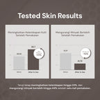 For Skin’s Sake FSS Dioic Acid Serum 2% with Azeclair 3.5% 30ml Acne Serum 360° Breakout Control Bantu Cegah dan Atasi Jerawat Berulang Kontrol Minyak serta Samarkan Bekas Jerawat PIE dan PIH