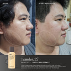 Salicylic Acid Toner 2% with Succinic Acid