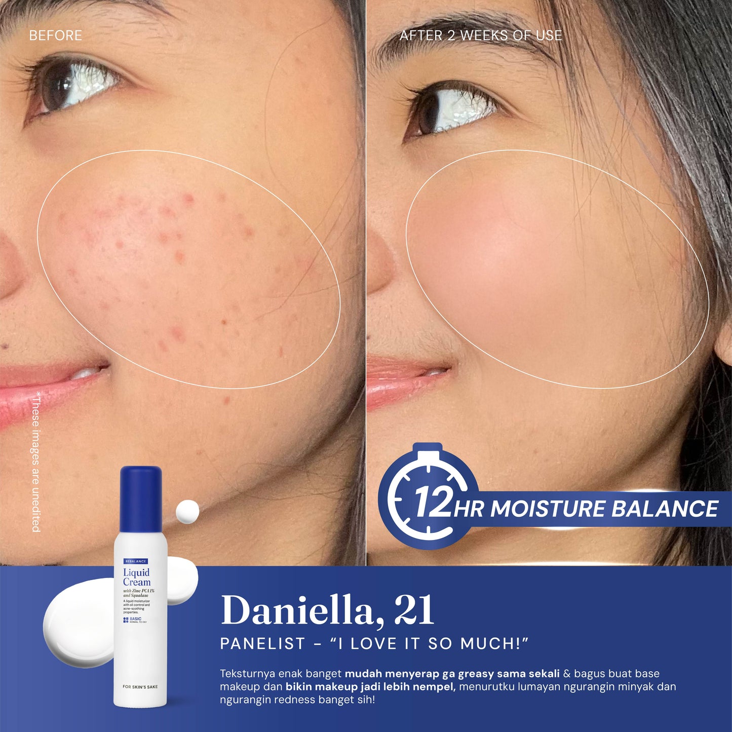 Liquid Cream Moisturizer with Zinc PCA 1% & Squalane