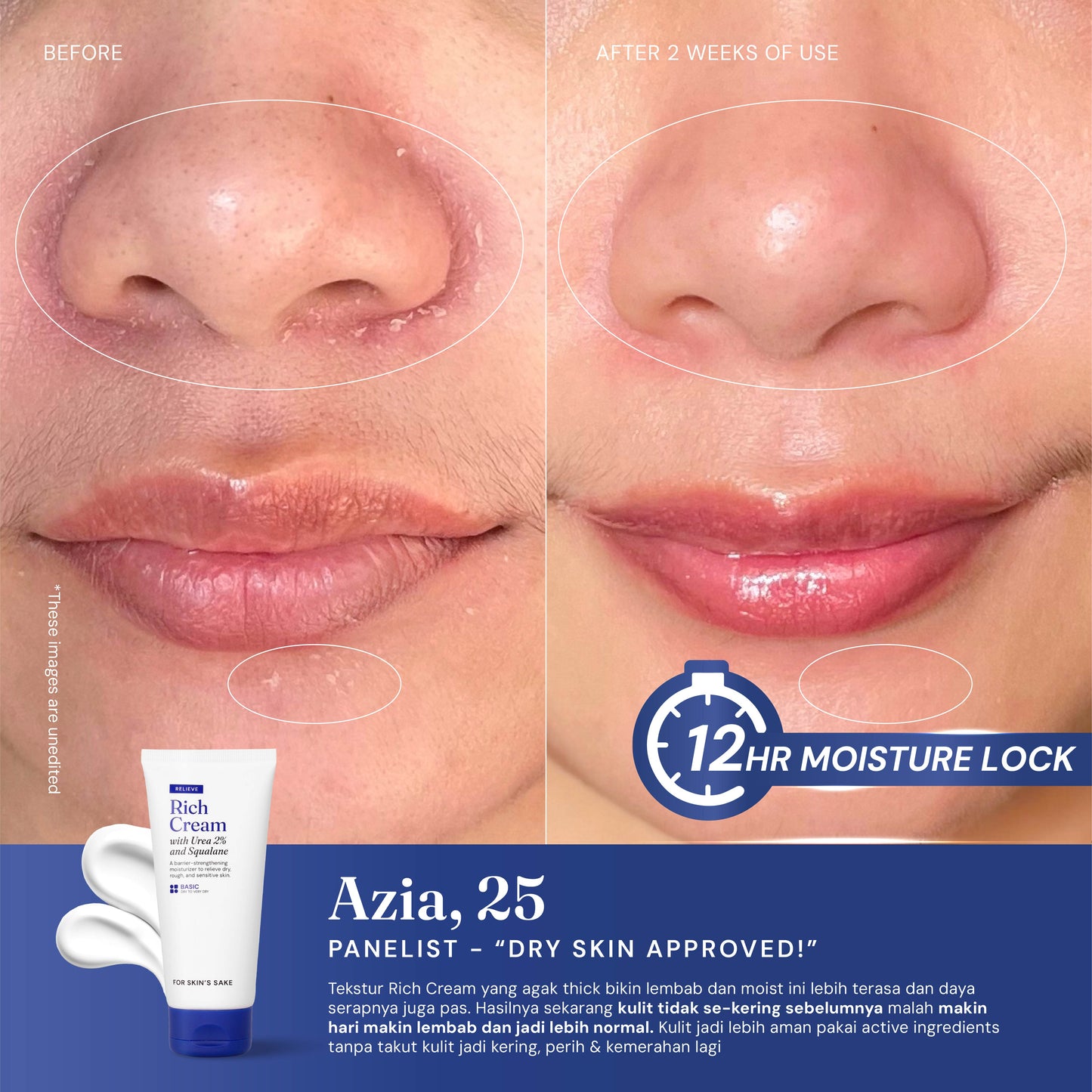 Rich Cream Moisturizer 2% Urea & Squalane