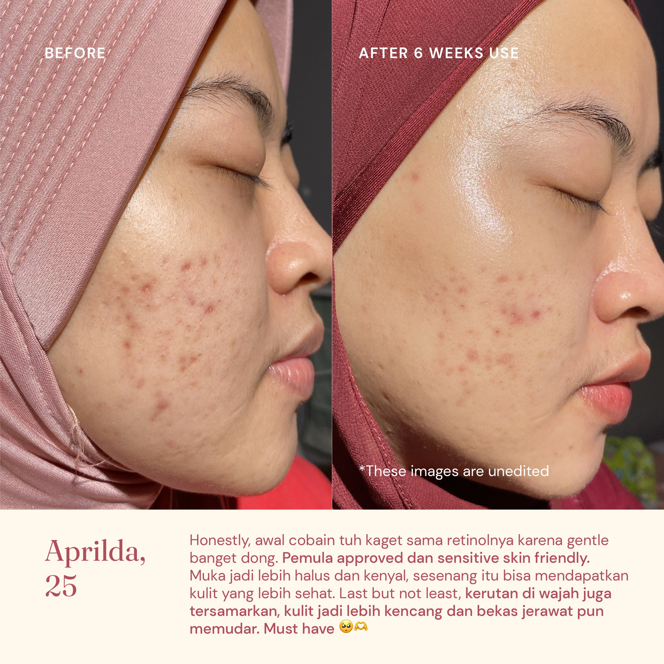 Retinol Serum 0.15% with Ceramide III FSS For Skin's Sake