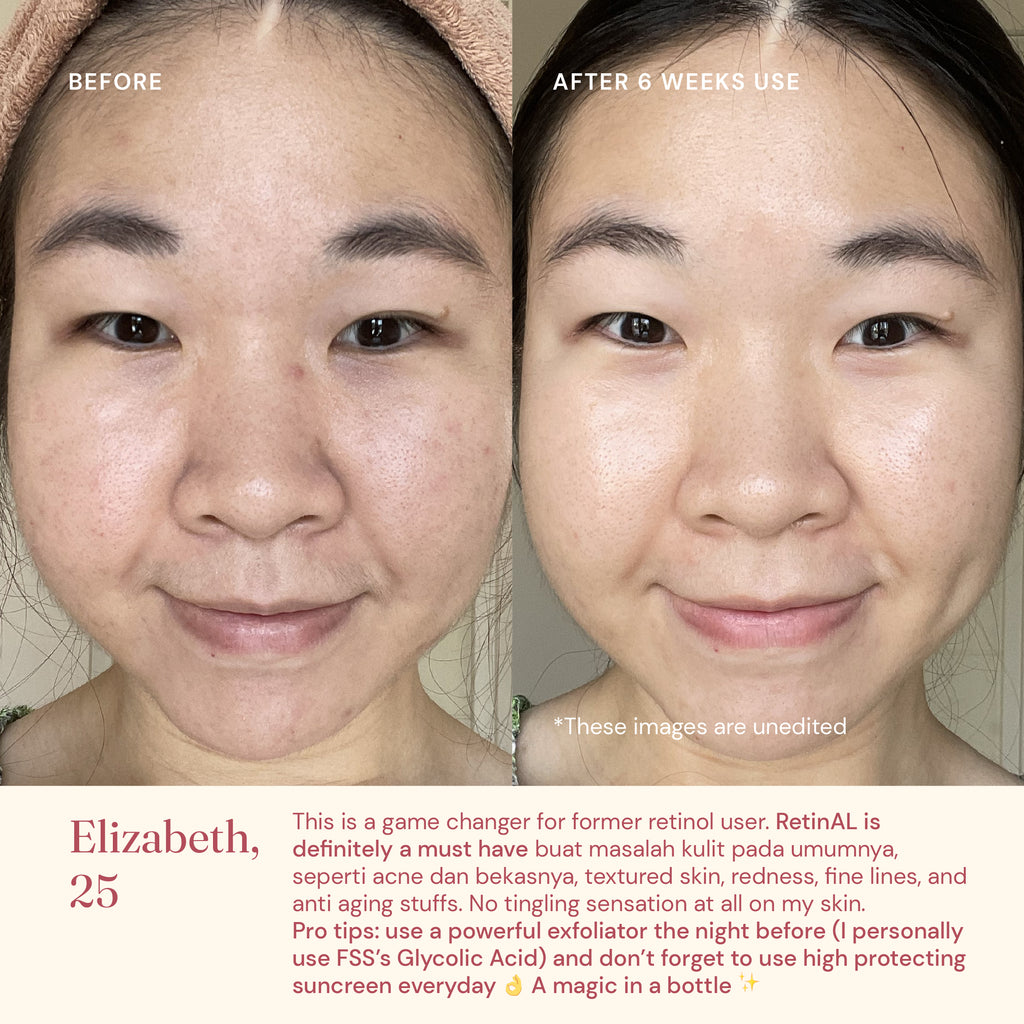 RetinAL Serum 0.15% with Samphira Oil FSS For Skin's Sake