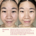 RetinAL Serum 0.15% with Samphira Oil FSS For Skin's Sake